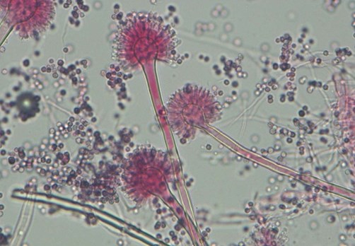 National Collection of Pathogenic Fungi (NCPF) - The UKBRCN National Collection of Pathogenic Fungi (NCPF) - The UKBRCN